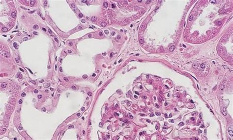 An Intro to H&E Staining: Protocol, Best Practices, Steps & More