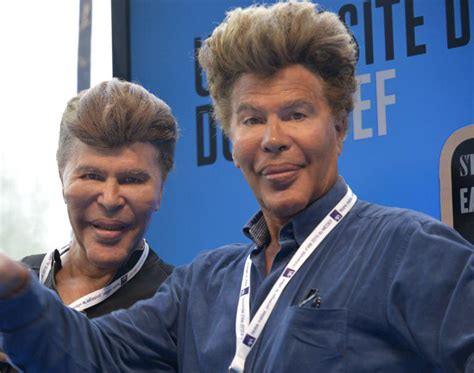 2 for one! i present... the bogdanoff brothers : r/Botchedsurgeries