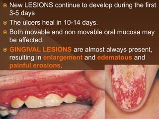 Herpetic Stomatitis Histology