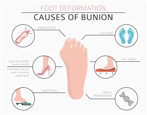 Is bunions treatment without surgery possible?