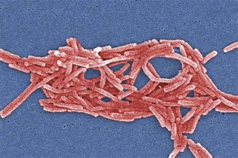 Argentina pneumonia outbreak: Lab tests suggest Legionnaires’ disease ...