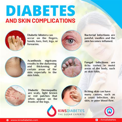 Skin Rash From Diabetes