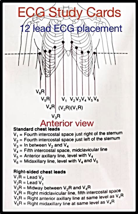 12lead placement | Emergency nursing, Ekg placement, Nursing school tips