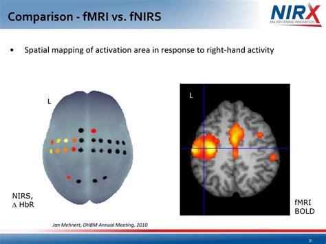 PPT - Part 01 - fNIRS : a cost-effective and robust technique for ...