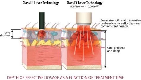 Class III vs Class IV Lasers - Aspen Laser University