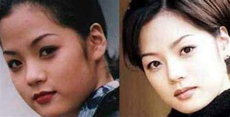 More Korean Actresses Plastic Surgery Before After Pictures – Those Who Have Admitted (Part One ...