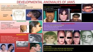 Developmental anomalies of jaws | PPT | Free Download