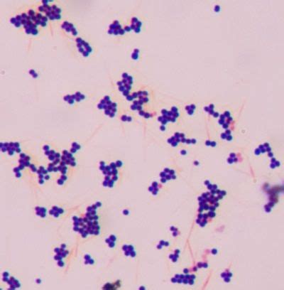 Gram-positive cocci (GPC) in clusters_Most likely a Staphylococcus species | Bacteriology ...