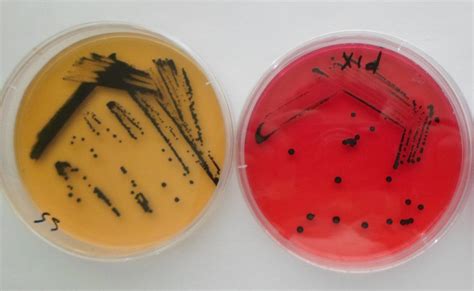 Salmonella Shigella agar Plate at Rs 60/plate | New Delhi | ID: 23836503362