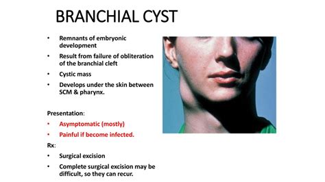 NECK MASSES. - ppt download