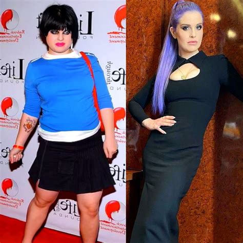 Kelly Osbourne’s Weight Loss Surgery Revealed - Mexico Bariatric Center®