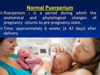 Puerperium lecture by Associate Prof.Dr. Aisha Elbareg | PPT