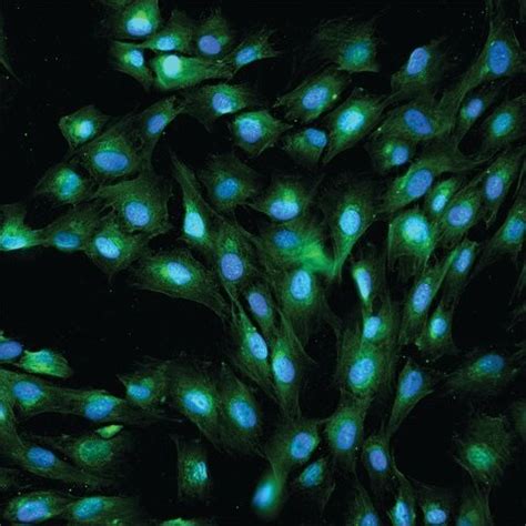 Anti-Von Willebrand Factor antibody (ab6994) | Abcam