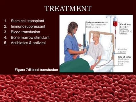 Aplastic anemia