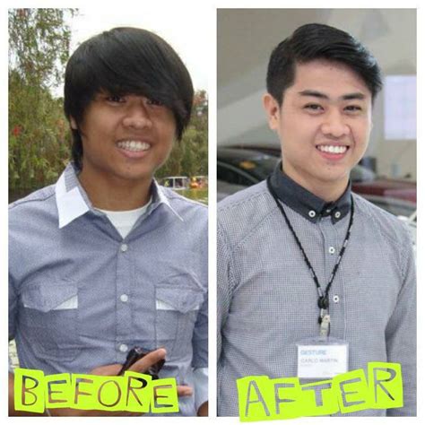 Royale Glutathione Users Before And After Photos