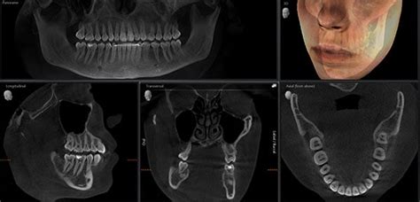 Dental CT Scan and Digital Radiography - Carson DDS