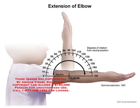 AMICUS Illustration of amicus,anatomy,range,motion,elbow,extension ...