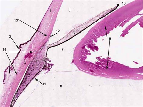 ANATOMY OF THE HUMAN EYE: EYE-MICROSCOPIC-SECTION-LABELED