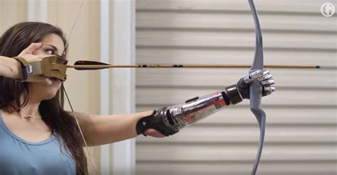 Beyond Bionics: How the Future of Prosthetics is Redefining Humanity