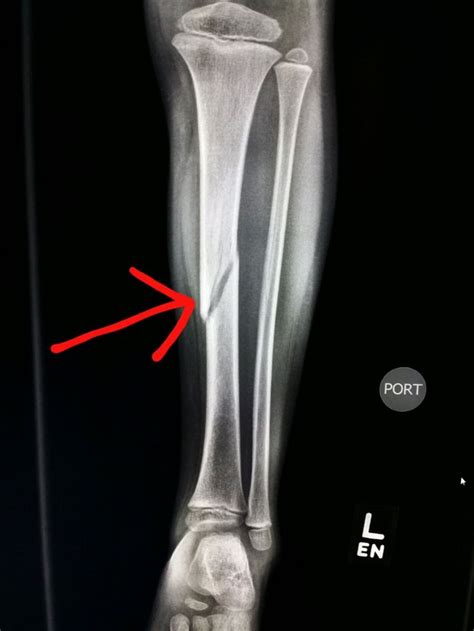 Pin on Unusual X-rays