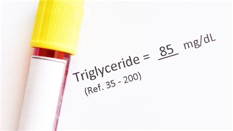 What Are Triglycerides and Why Is It Important to Keep Your Levels Low ...