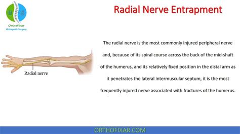 Radial Nerve Entrapment | OrthoFixar 2024