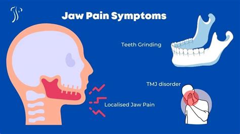 Jaw Pain Relief | TMJ Pain, Symptoms & Treatment | Dublin