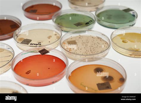 selective clinical microbiology lab culture medium to isolate Gram-negative and enteric bacilli ...