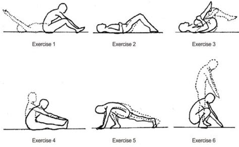 Lumbar Lordosis - Exercises, How to Fix, Treatment, What is