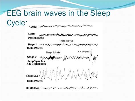 EEG: Basics