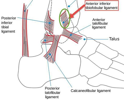 Anterior Tibiofibular Ligament Injury and Treatment | New Health Advisor