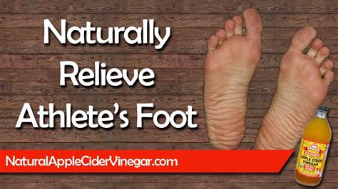 How to Cure Athlete's Foot Naturally with Apple Cider Vinegar - YouTube