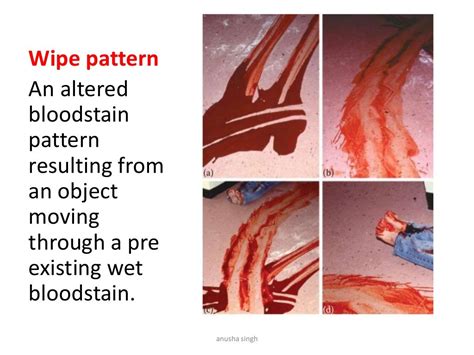 blood spatter analysis