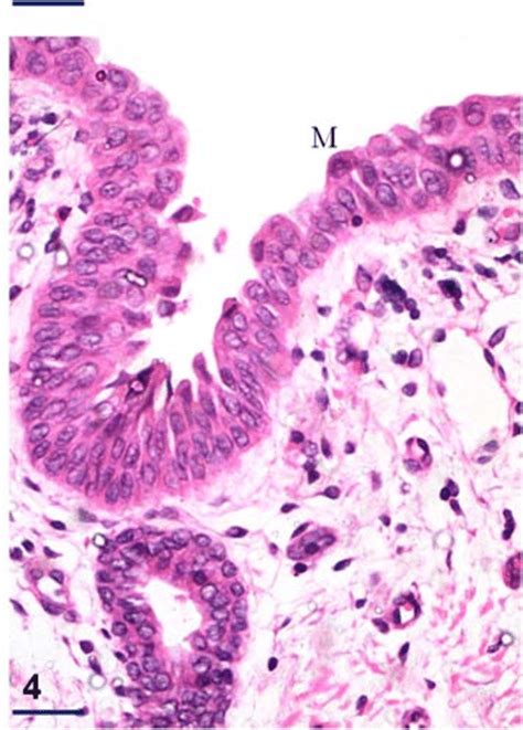 Photomicrograph of the tubal tonsil showing specialised epithelium not ...