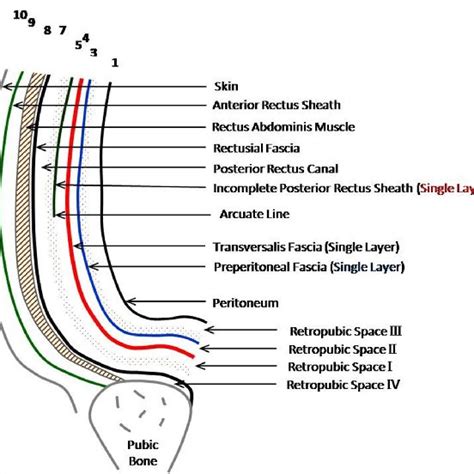 Boundaries of the classical retropubic space (Retzius) in presence of a ...