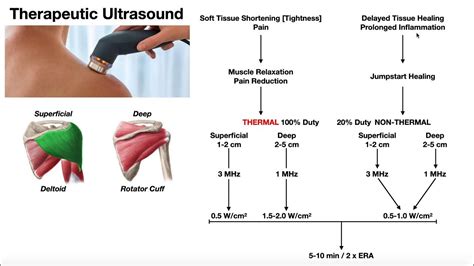 Therapeutic Ultrasound EXPLAINED | Use, Parameters, & Real Example ...