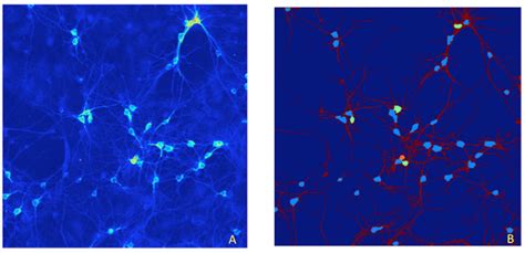 Example of 2D soma detection and separation of clustered somas on large... | Download Scientific ...