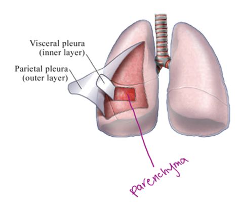 Pleural Effusion Flashcards | Quizlet