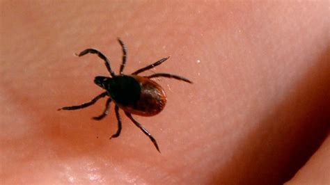 Black-legged ticks can carry the bacteria that causes Lyme disease. (Bertrand Guay/AFP/Getty Images)