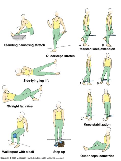 Chondromalacia Patella | Physical therapy exercises, Patellar ...