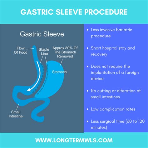 Long Term WLS / VSG | Gastric Sleeve Surgery - Dr. Jorge Maytorena - Weight Loss Surgery in ...