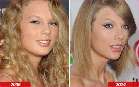 Taylor Swift Before and After | Hot Trending Now » Plastic Surgery Before And After # ...