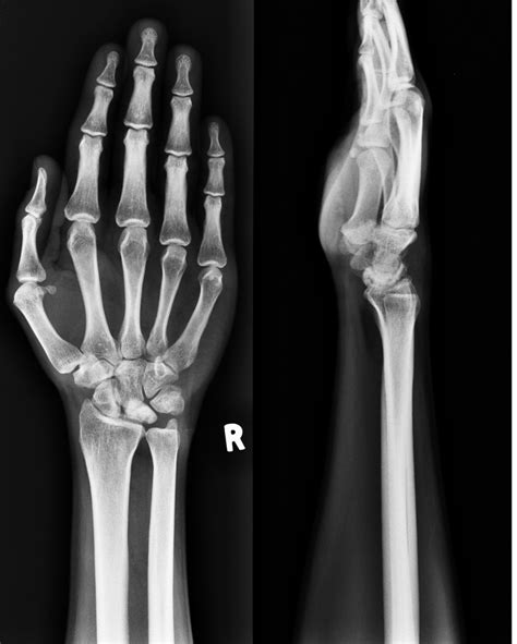 Image Quiz 10 #Wrist — OrthopaedicPrinciples.com