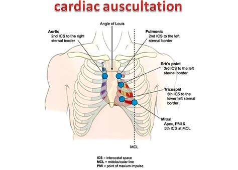 Midclavicular Line 5th Intercostal Space