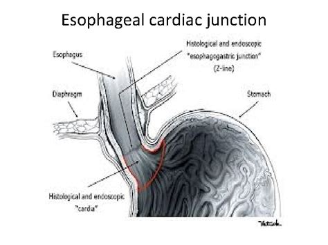 HISTOLOGY OF ESOPHAGUS GASTRO ESOPHAGEAL JUNCTION By Dr