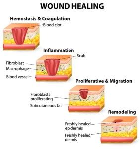 Skin Rejuvenation & Wound Healing | Spring Oasis