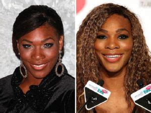 Serena Williams Before and After Plastic Surgery