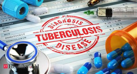 MDR-TB treatment cost: MDR-TB treatment could cost up to 25L in Mumbai, says study, Health News ...