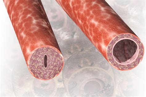 Patient-Reported Outcome Measurement Information System Validated in Systemic Vasculitis ...