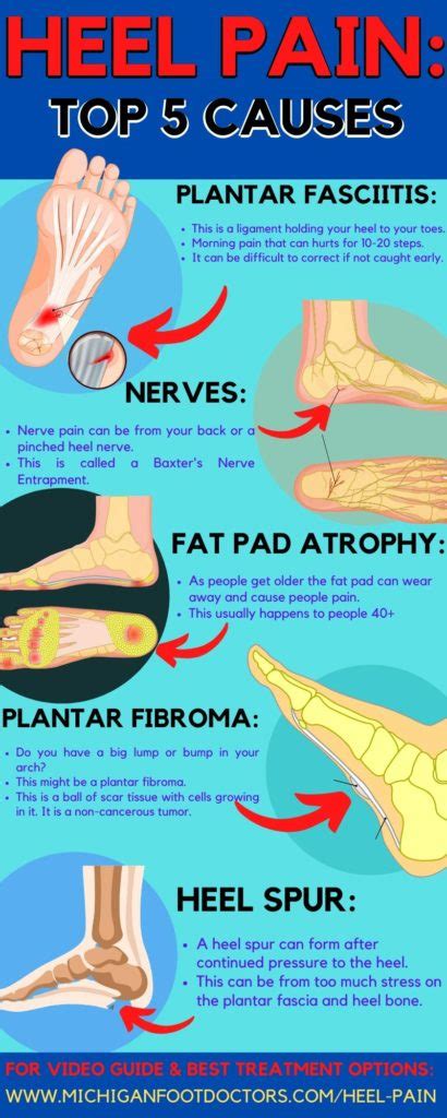 Painful Lump in the Arch of My Foot [Exercises & Home Treatment]